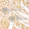 Proteasome 26S Subunit, Non-ATPase 2 antibody, A1999, ABclonal Technology, Immunohistochemistry paraffin image 