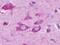 Endothelin B receptor-like protein 2 antibody, NLS406, Novus Biologicals, Immunohistochemistry paraffin image 