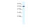 Zinc Finger Protein 266 antibody, 28-361, ProSci, Western Blot image 
