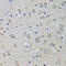 Single Stranded DNA Binding Protein 1 antibody, 22-609, ProSci, Immunohistochemistry frozen image 