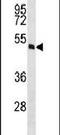 MOK Protein Kinase antibody, PA5-14476, Invitrogen Antibodies, Western Blot image 