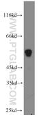 UDP-Glucose Ceramide Glucosyltransferase antibody, 12869-1-AP, Proteintech Group, Western Blot image 