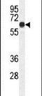 Coiled-Coil Domain Containing 8 antibody, PA5-24054, Invitrogen Antibodies, Western Blot image 