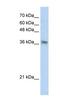 Phytanoyl-CoA 2-Hydroxylase Interacting Protein antibody, NBP1-56336, Novus Biologicals, Western Blot image 