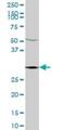 ER Membrane Protein Complex Subunit 2 antibody, H00009694-B01P, Novus Biologicals, Western Blot image 