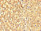 Betaine--Homocysteine S-Methyltransferase 2 antibody, CSB-PA11829A0Rb, Cusabio, Immunohistochemistry paraffin image 