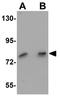 FRAS1 Related Extracellular Matrix 1 antibody, GTX85179, GeneTex, Western Blot image 