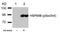 Heat Shock Protein 90 Alpha Family Class B Member 1 antibody, 79-469, ProSci, Western Blot image 