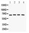 Cryptochrome Circadian Regulator 2 antibody, PA5-79073, Invitrogen Antibodies, Western Blot image 