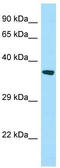 StAR Related Lipid Transfer Domain Containing 7 antibody, TA338027, Origene, Western Blot image 