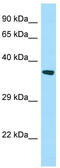 StAR-related lipid transfer protein 7, mitochondrial antibody, TA338027, Origene, Western Blot image 