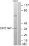Olfactory Receptor Family 51 Subfamily A Member 7 antibody, abx015437, Abbexa, Western Blot image 