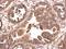 Eukaryotic Translation Initiation Factor 4A2 antibody, GTX101484, GeneTex, Immunohistochemistry paraffin image 