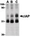 Baculoviral IAP Repeat Containing 2 antibody, orb86537, Biorbyt, Western Blot image 