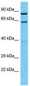 Tubulin polyglutamylase TTLL13 antibody, TA330809, Origene, Western Blot image 