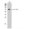 Erythropoietin Receptor antibody, LS-C381147, Lifespan Biosciences, Western Blot image 