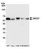 Zinc Finger Protein 207 antibody, A305-814A-M, Bethyl Labs, Western Blot image 