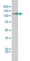 Protein Tyrosine Kinase 2 antibody, H00005747-M01, Novus Biologicals, Western Blot image 