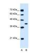 Glutamic-Oxaloacetic Transaminase 2 antibody, NBP1-80521, Novus Biologicals, Western Blot image 