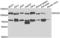 DEAD-Box Helicase 20 antibody, LS-C334313, Lifespan Biosciences, Western Blot image 