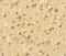 SWI/SNF Related, Matrix Associated, Actin Dependent Regulator Of Chromatin, Subfamily A, Member 4 antibody, NBP2-41270, Novus Biologicals, Immunohistochemistry paraffin image 