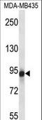 Glutamate Metabotropic Receptor 6 antibody, LS-C166686, Lifespan Biosciences, Western Blot image 