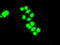 Checkpoint Kinase 2 antibody, LS-C784219, Lifespan Biosciences, Immunofluorescence image 