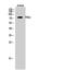 Praja Ring Finger Ubiquitin Ligase 2 antibody, A08677, Boster Biological Technology, Western Blot image 