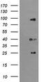 Ubiquitin Specific Peptidase 16 antibody, M05795, Boster Biological Technology, Western Blot image 