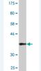 Bromodomain Adjacent To Zinc Finger Domain 2B antibody, H00029994-M07, Novus Biologicals, Western Blot image 