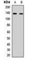 RE1 Silencing Transcription Factor antibody, LS-C668231, Lifespan Biosciences, Western Blot image 