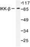 Inhibitor Of Nuclear Factor Kappa B Kinase Subunit Beta antibody, LS-C176285, Lifespan Biosciences, Western Blot image 