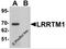 Leucine Rich Repeat Transmembrane Neuronal 1 antibody, 6167, ProSci, Western Blot image 