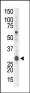 Receptor For Activated C Kinase 1 antibody, MBS9212879, MyBioSource, Western Blot image 