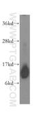 Inner Mitochondrial Membrane Peptidase Subunit 2 antibody, 15970-1-AP, Proteintech Group, Western Blot image 