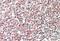 CD2 Cytoplasmic Tail Binding Protein 2 antibody, GTX89547, GeneTex, Immunohistochemistry paraffin image 