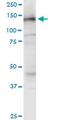 NODAL Modulator 3 antibody, MA5-24540, Invitrogen Antibodies, Western Blot image 
