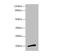 Neuromedin U antibody, LS-C676173, Lifespan Biosciences, Western Blot image 