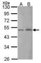 C-Terminal Binding Protein 2 antibody, NBP2-16024, Novus Biologicals, Western Blot image 