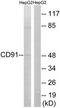 LDL Receptor Related Protein 1 antibody, TA311988, Origene, Western Blot image 