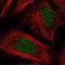 TOX antibody, HPA073241, Atlas Antibodies, Immunocytochemistry image 