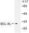 Bcl-XS antibody, AP06498PU-N, Origene, Western Blot image 