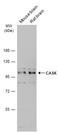 Calcium/Calmodulin Dependent Serine Protein Kinase antibody, GTX111513, GeneTex, Western Blot image 