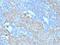 c-Kit antibody, NBP2-29423, Novus Biologicals, Immunohistochemistry paraffin image 