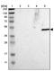 Galactose-1-Phosphate Uridylyltransferase antibody, PA5-52125, Invitrogen Antibodies, Western Blot image 