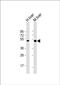 Chitobiase antibody, PA5-72338, Invitrogen Antibodies, Western Blot image 