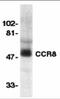 C-C chemokine receptor type 8 antibody, 2097, ProSci, Western Blot image 