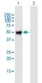 Oncostatin M Receptor antibody, H00009180-B01P, Novus Biologicals, Western Blot image 