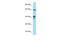 Actin Like 8 antibody, A17253, Boster Biological Technology, Western Blot image 