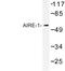 Autoimmune Regulator antibody, LS-C176701, Lifespan Biosciences, Western Blot image 